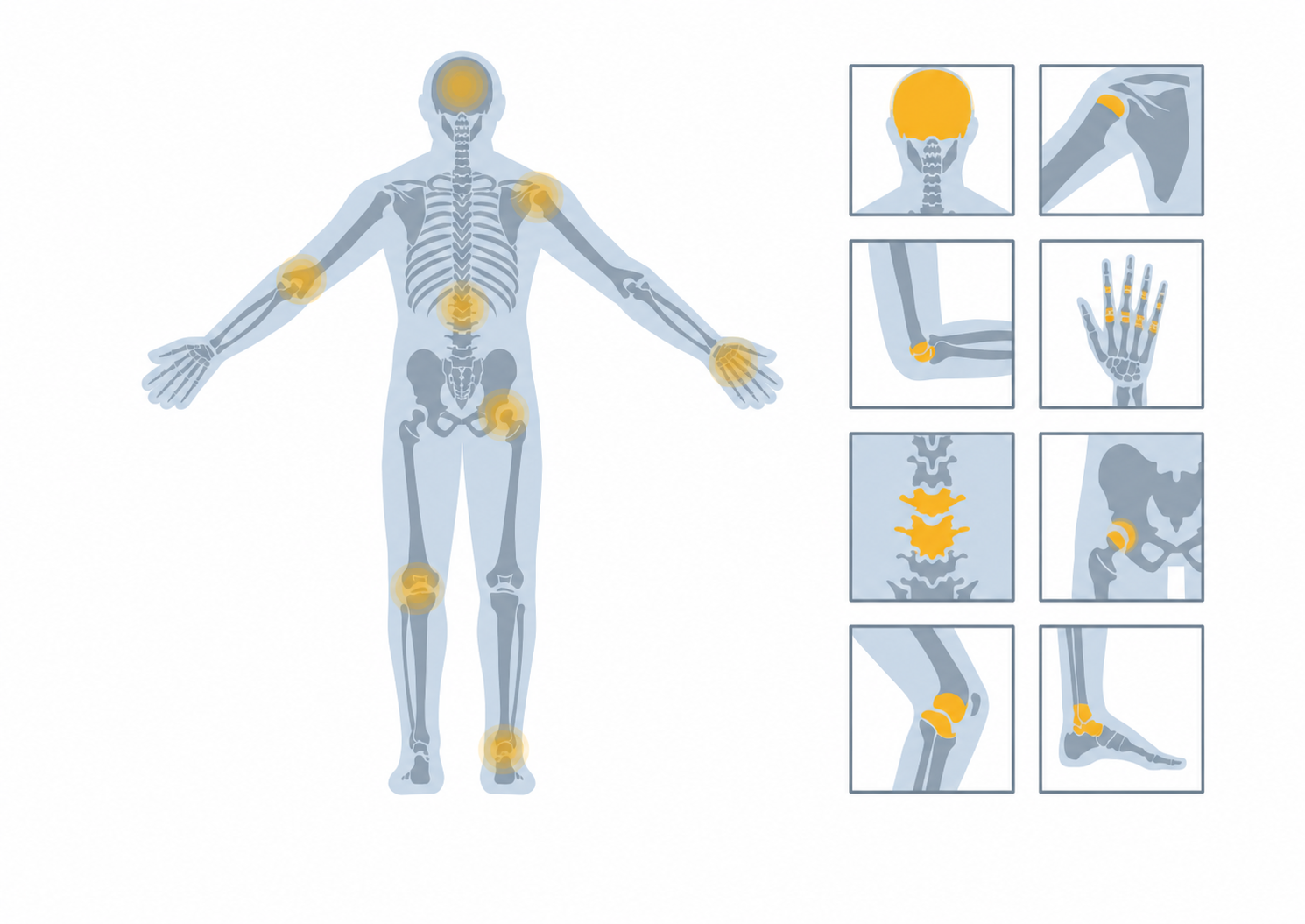 Ilustração das principais áreas médicas de aplicação de implantes